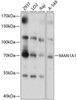 Western blot analysis of extracts of various cell lines, using MAN1A1 antibody (13-824) at 1:1000 dilution.<br/>Secondary antibody: HRP Goat Anti-Rabbit IgG (H+L) at 1:10000 dilution.<br/>Lysates/proteins: 25ug per lane.<br/>Blocking buffer: 3% nonfat dry milk in TBST.<br/>Detection: ECL Basic Kit.<br/>Exposure time: 1s.