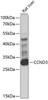 Western blot analysis of extracts of rat liver, using CCND3 antibody (13-830) at 1:1000 dilution.<br/>Secondary antibody: HRP Goat Anti-Rabbit IgG (H+L) at 1:10000 dilution.<br/>Lysates/proteins: 25ug per lane.<br/>Blocking buffer: 3% nonfat dry milk in TBST.<br/>Detection: ECL Basic Kit.<br/>Exposure time: 10s.