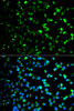Immunofluorescence analysis of HeLa cells using TYMP antibody (13-864) . Blue: DAPI for nuclear staining.