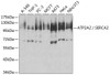 Western blot analysis of extracts of various cell lines, using ATP2A2 / SERCA2 antibody (13-873) at 1:500 dilution.<br/>Secondary antibody: HRP Goat Anti-Rabbit IgG (H+L) at 1:10000 dilution.<br/>Lysates/proteins: 25ug per lane.<br/>Blocking buffer: 3% nonfat dry milk in TBST.