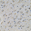 Immunohistochemistry of paraffin-embedded rat brain using ATP2A2 / SERCA2 Antibody (13-873) at dilution of 1:100 (40x lens) .