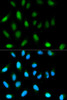 Immunofluorescence analysis of HeLa cells using CBX5 antibody (13-877) . Blue: DAPI for nuclear staining.