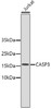 Western blot analysis of extracts of Jurkat cells, using CASP3 antibody (13-887) .<br/>Secondary antibody: HRP Goat Anti-Rabbit IgG (H+L) at 1:10000 dilution.<br/>Lysates/proteins: 25ug per lane.<br/>Blocking buffer: 3% nonfat dry milk in TBST.