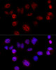 Immunofluorescence analysis of HeLa cells using Cyclin D1 antibody (13-888) at dilution of 1:100 (40x lens) . Blue: DAPI for nuclear staining.