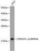 Western blot analysis of extracts of 293T cells, using CDKN2A / p16INK4a antibody (13-896) .<br/>Secondary antibody: HRP Goat Anti-Rabbit IgG (H+L) at 1:10000 dilution.<br/>Lysates/proteins: 25ug per lane.<br/>Blocking buffer: 3% nonfat dry milk in TBST.
