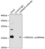Immunoprecipitation analysis of 200ug extracts of 293T cells, using 3 ug CDKN2A / p16INK4a antibody (13-896) . Western blot was performed from the immunoprecipitate using CDKN2A / p16INK4a antibody (13-896) at a dilition of 1:1000.