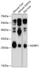 Western blot analysis of extracts of various cell lines, using IGFBP1 antibody (13-915) at 1:1000 dilution.<br/>Secondary antibody: HRP Goat Anti-Rabbit IgG (H+L) at 1:10000 dilution.<br/>Lysates/proteins: 25ug per lane.<br/>Blocking buffer: 3% nonfat dry milk in TBST.<br/>Detection: ECL Basic Kit.<br/>Exposure time: 5s.