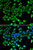 Immunofluorescence analysis of A-549 cells using LCN2 antibody (13-925) . Blue: DAPI for nuclear staining.