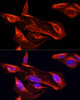 Immunofluorescence analysis of U2OS cells using MMP2 antibody (13-931) at dilution of 1:100. Blue: DAPI for nuclear staining.