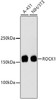 Western blot analysis of extracts of various cell lines, using ROCK1 antibody (13-936) .<br/>Secondary antibody: HRP Goat Anti-Rabbit IgG (H+L) at 1:10000 dilution.<br/>Lysates/proteins: 25ug per lane.<br/>Blocking buffer: 3% nonfat dry milk in TBST.