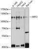 Western blot analysis of extracts of various cell lines, using NRF2 antibody (13-937) at 1:1000 dilution.<br/>Secondary antibody: HRP Goat Anti-Rabbit IgG (H+L) at 1:10000 dilution.<br/>Lysates/proteins: 25ug per lane.<br/>Blocking buffer: 3% nonfat dry milk in TBST.<br/>Detection: ECL Basic Kit.<br/>Exposure time: 10s.