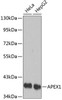 Western blot analysis of extracts of various cell lines, using APEX1 antibody (13-943) .<br/>Secondary antibody: HRP Goat Anti-Rabbit IgG (H+L) at 1:10000 dilution.<br/>Lysates/proteins: 25ug per lane.<br/>Blocking buffer: 3% nonfat dry milk in TBST.