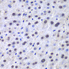 Immunohistochemistry of paraffin-embedded human liver damage using APEX1 antibody (13-943) at dilution of 1:100 (40x lens) .