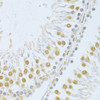 Immunohistochemistry of paraffin-embedded rat testis using POLR2A antibody (13-946) at dilution of 1:100 (40x lens) .