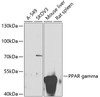 Western blot analysis of extracts of various cell lines, using PPAR gamma antibody (13-947) at 1:1000 dilution.<br/>Secondary antibody: HRP Goat Anti-Rabbit IgG (H+L) at 1:10000 dilution.<br/>Lysates/proteins: 25ug per lane.<br/>Blocking buffer: 3% nonfat dry milk in TBST.<br/>Detection: ECL Basic Kit.<br/>Exposure time: 90s.