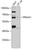 Western blot analysis of extracts of various cell lines, using PRKAA1 antibody (13-948) at 1:1000 dilution.<br/>Secondary antibody: HRP Goat Anti-Rabbit IgG (H+L) at 1:10000 dilution.<br/>Lysates/proteins: 25ug per lane.<br/>Blocking buffer: 3% nonfat dry milk in TBST.<br/>Detection: ECL Basic Kit.<br/>Exposure time: 90s.