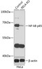 Western blot analysis of extracts from normal (control) and NF-kB p65 knockout (KO) HeLa cells, using NF-kB p65 antibody (13-953) at 1:1000 dilution.<br/>Secondary antibody: HRP Goat Anti-Rabbit IgG (H+L) at 1:10000 dilution.<br/>Lysates/proteins: 25ug per lane.<br/>Blocking buffer: 3% nonfat dry milk in TBST.<br/>Detection: ECL Basic Kit.<br/>Exposure time: 30s.