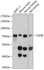 Western blot analysis of extracts of various cell lines, using TGFBI antibody (13-956) at 1:1000 dilution.<br/>Secondary antibody: HRP Goat Anti-Rabbit IgG (H+L) at 1:10000 dilution.<br/>Lysates/proteins: 25ug per lane.<br/>Blocking buffer: 3% nonfat dry milk in TBST.<br/>Detection: ECL Basic Kit.<br/>Exposure time: 1s.