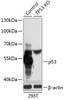 Western blot analysis of extracts from normal (control) and p53 knockout (KO) 293T cells, using p53 antibody (13-958) at 1:1000 dilution.<br/>Secondary antibody: HRP Goat Anti-Rabbit IgG (H+L) at 1:10000 dilution.<br/>Lysates/proteins: 25ug per lane.<br/>Blocking buffer: 3% nonfat dry milk in TBST.<br/>Detection: ECL Basic Kit.<br/>Exposure time: 5s.