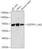 Western blot analysis of extracts of various cell lines, using SQSTM1 antibody (13-962) at 1:1000 dilution.<br/>Secondary antibody: HRP Goat Anti-Rabbit IgG (H+L) at 1:10000 dilution.<br/>Lysates/proteins: 25ug per lane.<br/>Blocking buffer: 3% nonfat dry milk in TBST.<br/>Detection: ECL Basic Kit.<br/>Exposure time: 30s.