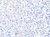 Immunohistochemistry of paraffin-embedded human tonsil using SQSTM1 / p62 antibody (13-962) at dilution of 1:100 (40x lens) .