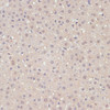 Immunohistochemistry of paraffin-embedded rat liver using YAP1 antibody (13-967) at dilution of 1:100 (40x lens) .