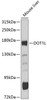 Western blot analysis of extracts of mouse liver, using DOT1L antibody (13-973) at 1:1000 dilution.<br/>Secondary antibody: HRP Goat Anti-Rabbit IgG (H+L) at 1:10000 dilution.<br/>Lysates/proteins: 25ug per lane.<br/>Blocking buffer: 3% nonfat dry milk in TBST.<br/>Detection: ECL Basic Kit.<br/>Exposure time: 90s.