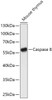 Western blot analysis of extracts of Mouse thymus, using Casp8 antibody (13-984) at 1:1000 dilution.<br/>Secondary antibody: HRP Goat Anti-Rabbit IgG (H+L) at 1:10000 dilution.<br/>Lysates/proteins: 25ug per lane.<br/>Blocking buffer: 3% nonfat dry milk in TBST.<br/>Detection: ECL Enhanced Kit.<br/>Exposure time: 90s.