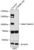 Western blot analysis of extracts from normal (control) and beta Catenin knockout (KO) 293T cells, using beta Catenin antibody (13-991) at 1:1000 dilution.<br/>Secondary antibody: HRP Goat Anti-Rabbit IgG (H+L) at 1:10000 dilution.<br/>Lysates/proteins: 25ug per lane.<br/>Blocking buffer: 3% nonfat dry milk in TBST.<br/>Detection: ECL Basic Kit.<br/>Exposure time: 90s.