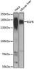 Western blot analysis of extracts of various cell lines, using EGFR antibody (13-995) at 1:1000 dilution.<br/>Secondary antibody: HRP Goat Anti-Rabbit IgG (H+L) at 1:10000 dilution.<br/>Lysates/proteins: 25ug per lane.<br/>Blocking buffer: 3% nonfat dry milk in TBST.<br/>Detection: ECL Enhanced Kit.<br/>Exposure time: 30s.