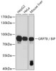 Western blot analysis of extracts of various cell lines, using HSPA5 antibody (13-999) at 1:1000 dilution.<br/>Secondary antibody: HRP Goat Anti-Rabbit IgG (H+L) at 1:10000 dilution.<br/>Lysates/proteins: 25ug per lane.<br/>Blocking buffer: 3% nonfat dry milk in TBST.<br/>Detection: ECL Basic Kit.<br/>Exposure time: 180s.