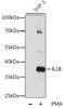 Western blot analysis of extracts of various cell lines, using IL1B antibody (14-002) at 1:1000 dilution. THP-1 cells were treated by PMA (80 nM) for overnight.<br/>Secondary antibody: HRP Goat Anti-Rabbit IgG (H+L) at 1:10000 dilution.<br/>Lysates/proteins: 25ug per lane.<br/>Blocking buffer: 3% nonfat dry milk in TBST.<br/>Detection: ECL Basic Kit.<br/>Exposure time: 5s.