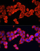 Immunofluorescence analysis of HeLa cells using IL1B antibody (14-002) at dilution of 1:100. Blue: DAPI for nuclear staining.
