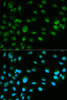 Immunofluorescence analysis of HeLa cells using MCM7 antibody (14-005) . Blue: DAPI for nuclear staining.