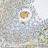 Immunohistochemistry of paraffin-embedded rat ovary using SMAD3 antibody (14-008) at dilution of 1:100 (40x lens) .