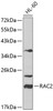 Western blot analysis of extracts of HL-60 cells, using RAC2 antibody (14-009) at 1:1000 dilution.<br/>Secondary antibody: HRP Goat Anti-Rabbit IgG (H+L) at 1:10000 dilution.<br/>Lysates/proteins: 25ug per lane.<br/>Blocking buffer: 3% nonfat dry milk in TBST.