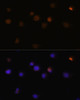 Immunofluorescence analysis of Y79 cells using Rb Polyclonal Antibody (14-015) at dilution of 1:100 (40x lens) . Blue: DAPI for nuclear staining.