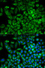 Immunofluorescence analysis of A549 cells using ALDOA antibody (14-017) . Blue: DAPI for nuclear staining.