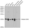 Western blot analysis of extracts of various cell lines, using Histone H2AX antibody (14-029) at 1:1000 dilution.<br/>Secondary antibody: HRP Goat Anti-Rabbit IgG (H+L) at 1:10000 dilution.<br/>Lysates/proteins: 25ug per lane.<br/>Blocking buffer: 3% nonfat dry milk in TBST.<br/>Detection: ECL Basic Kit.<br/>Exposure time: 15s.