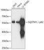 Western blot analysis of extracts of various cell lines, using SQSTM1 antibody (14-033) at 1:1000 dilution.<br/>Secondary antibody: HRP Goat Anti-Rabbit IgG (H+L) at 1:10000 dilution.<br/>Lysates/proteins: 25ug per lane.<br/>Blocking buffer: 3% nonfat dry milk in TBST.<br/>Detection: ECL Basic Kit.<br/>Exposure time: 1s.