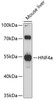 Western blot analysis of extracts of mouse liver, using HNF4a antibody (14-035) at 1:1000 dilution.<br/>Secondary antibody: HRP Goat Anti-Rabbit IgG (H+L) at 1:10000 dilution.<br/>Lysates/proteins: 25ug per lane.<br/>Blocking buffer: 3% nonfat dry milk in TBST.<br/>Detection: ECL Basic Kit.<br/>Exposure time: 90s.