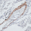 Immunohistochemistry of paraffin-embedded human lung using TPM1 antibody (14-051) at dilution of 1:100 (40x lens) .