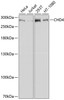 Western blot analysis of extracts of various cell lines, using CHD4 antibody (14-052) at 1:1000 dilution.<br/>Secondary antibody: HRP Goat Anti-Rabbit IgG (H+L) at 1:10000 dilution.<br/>Lysates/proteins: 25ug per lane.<br/>Blocking buffer: 3% nonfat dry milk in TBST.<br/>Detection: ECL Basic Kit.<br/>Exposure time: 30s.