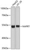 Western blot analysis of extracts of various cell lines, using NAPRT Antibody (14-060) at 1:3000 dilution.<br/>Secondary antibody: HRP Goat Anti-Rabbit IgG (H+L) at 1:10000 dilution.<br/>Lysates/proteins: 25ug per lane.<br/>Blocking buffer: 3% nonfat dry milk in TBST.<br/>Detection: ECL Basic Kit.<br/>Exposure time: 30s.