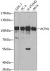 Western blot analysis of extracts of various cell lines, using ACTN1 antibody (14-062) at 1:500 dilution.<br/>Secondary antibody: HRP Goat Anti-Rabbit IgG (H+L) at 1:10000 dilution.<br/>Lysates/proteins: 25ug per lane.<br/>Blocking buffer: 3% nonfat dry milk in TBST.