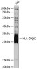 Western blot analysis of extracts of Raji cells, using HLA-DQB2 antibody (14-064) at 1:3000 dilution.<br/>Secondary antibody: HRP Goat Anti-Rabbit IgG (H+L) at 1:10000 dilution.<br/>Lysates/proteins: 25ug per lane.<br/>Blocking buffer: 3% nonfat dry milk in TBST.<br/>Detection: ECL Basic Kit.<br/>Exposure time: 30s.