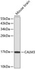 Western blot analysis of extracts of mouse brain, using CALM3 antibody (14-065) .<br/>Secondary antibody: HRP Goat Anti-Rabbit IgG (H+L) at 1:10000 dilution.<br/>Lysates/proteins: 25ug per lane.<br/>Blocking buffer: 3% nonfat dry milk in TBST.