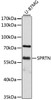 Western blot analysis of extracts of U-87MG cells, using SPRTN antibody (14-070) at 1:3000 dilution.<br/>Secondary antibody: HRP Goat Anti-Rabbit IgG (H+L) at 1:10000 dilution.<br/>Lysates/proteins: 25ug per lane.<br/>Blocking buffer: 3% nonfat dry milk in TBST.<br/>Detection: ECL Basic Kit.<br/>Exposure time: 60s.