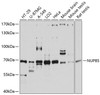 Western blot analysis of extracts of various cell lines, using NUP85 antibody (14-074) at 1:3000 dilution.<br/>Secondary antibody: HRP Goat Anti-Rabbit IgG (H+L) at 1:10000 dilution.<br/>Lysates/proteins: 25ug per lane.<br/>Blocking buffer: 3% nonfat dry milk in TBST.<br/>Detection: ECL Basic Kit.<br/>Exposure time: 10s.