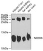 Western blot analysis of extracts of various cell lines, using NEDD8 antibody (14-075) at 1:1000 dilution.<br/>Secondary antibody: HRP Goat Anti-Rabbit IgG (H+L) at 1:10000 dilution.<br/>Lysates/proteins: 25ug per lane.<br/>Blocking buffer: 3% nonfat dry milk in TBST.<br/>Detection: ECL Enhanced Kit.<br/>Exposure time: 60s.